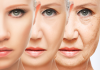 bioestimuladores de colágeno-rejuvenecimento