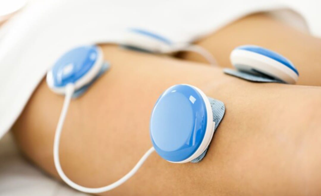 Corrente Russa: Fundamentos Científicos e Benefícios da Estimulação Muscular