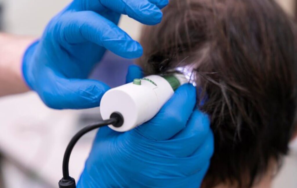 Tratamento das Disfunções do Couro Cabeludo: Abordagem Científica e Importância para a Saúde Capilar