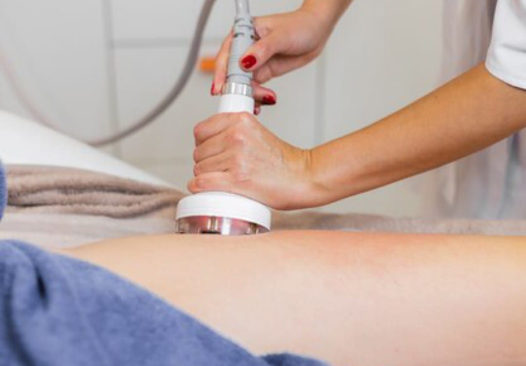 como-reduzir-a-celulite-em-trinta-dias-sem-metodos-cirurgicos