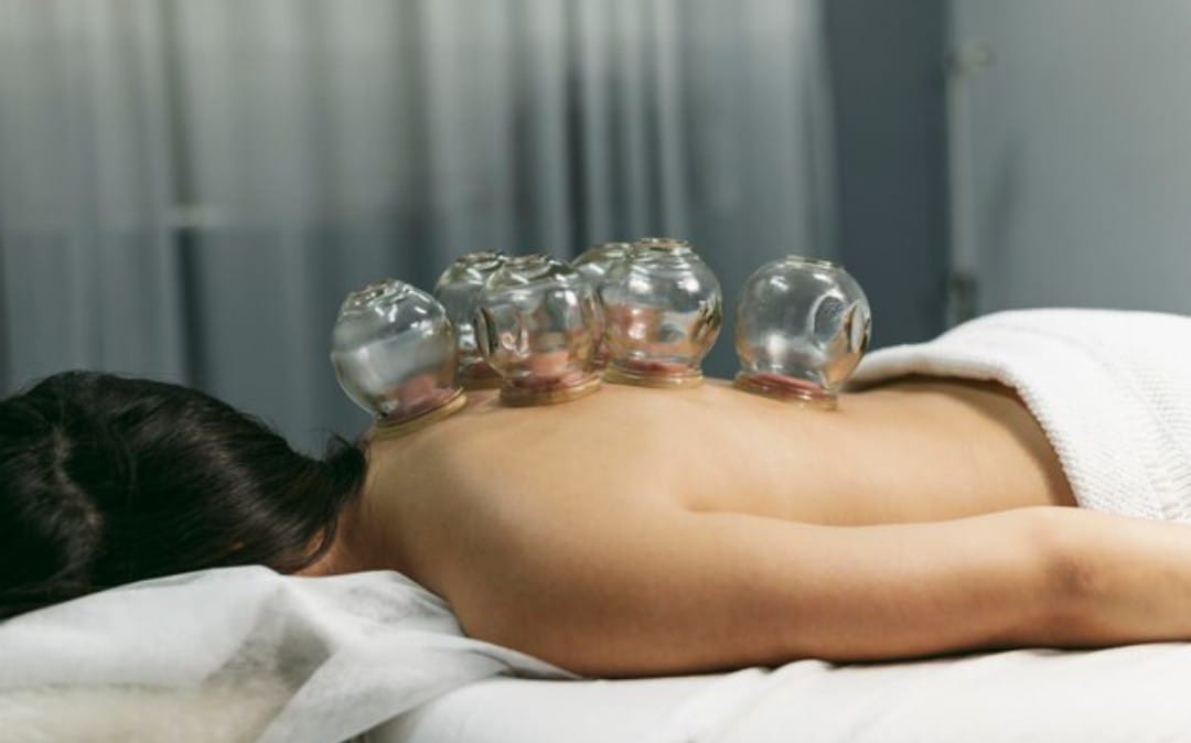 Ventosaterapia: Fundamentos Científicos e Benefícios para a Saúde e o Bem-Estar