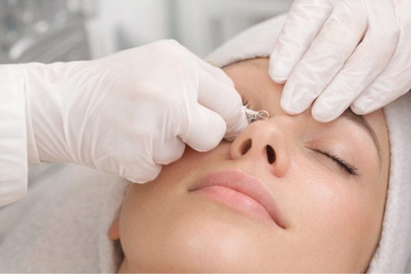 extracao-dos-comedoes-da-pele.