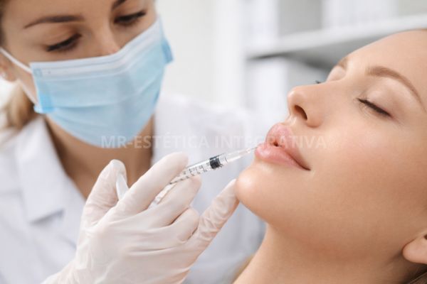 Preenchimento Labial com Técnica em Seringa: O Que É, Como Funciona e Por Que Essa Técnica Está em Alta