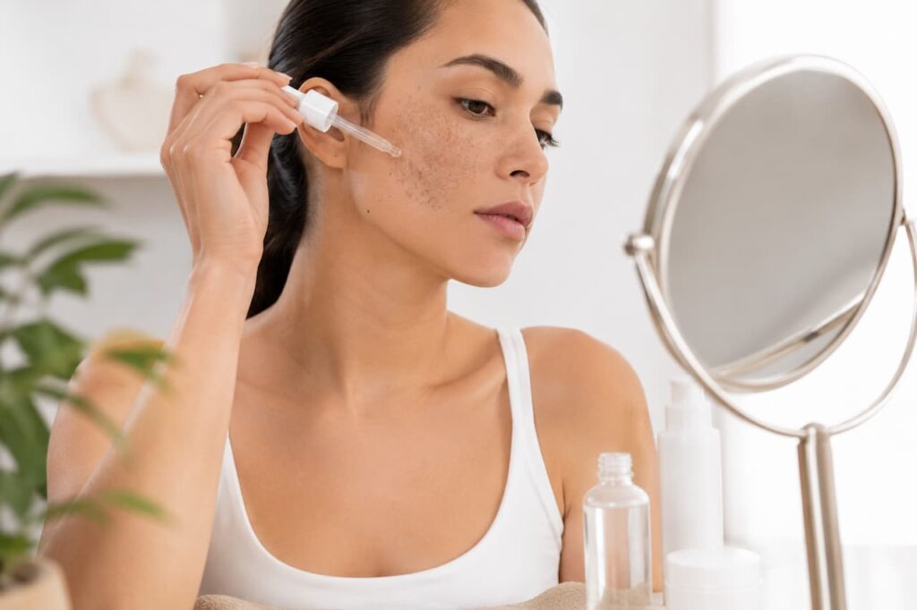 Como usar niacinamida no melasma para clarear a pele com segurança e reduzir manchas faciais”