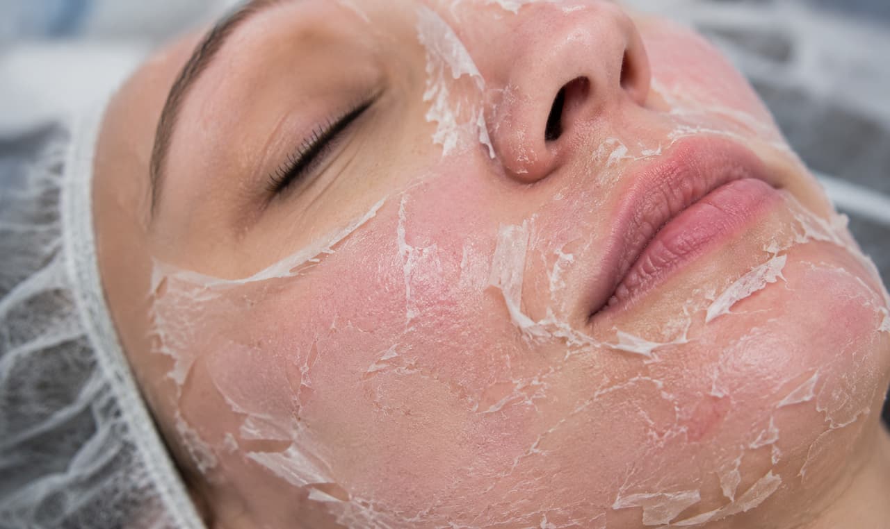 peeling quimico