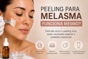 Peeling para Melasma Funciona Mesmo?