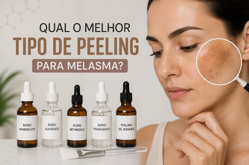 qual o melhor tipo de peeling para melasma